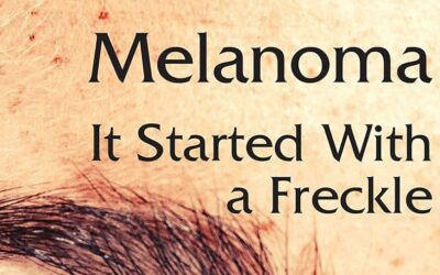 A Melanoma Story: It Started with a Freckle
