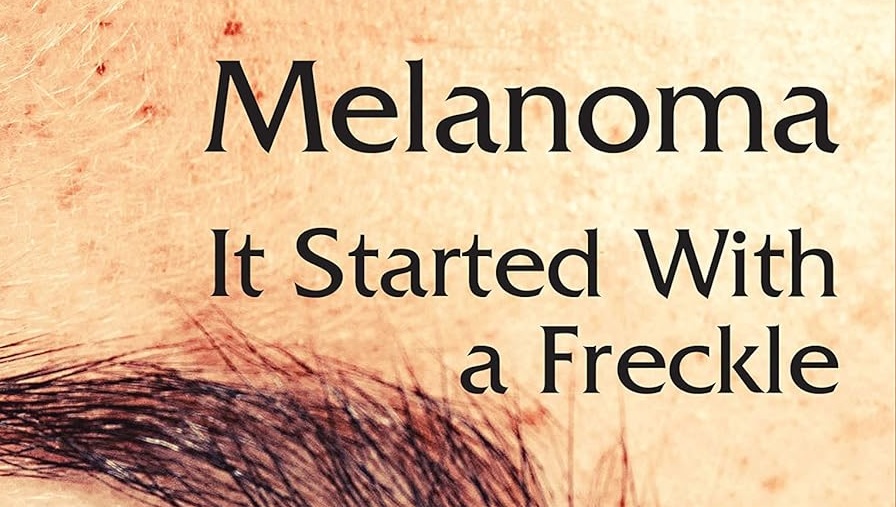 A Melanoma Story: It Started with a Freckle